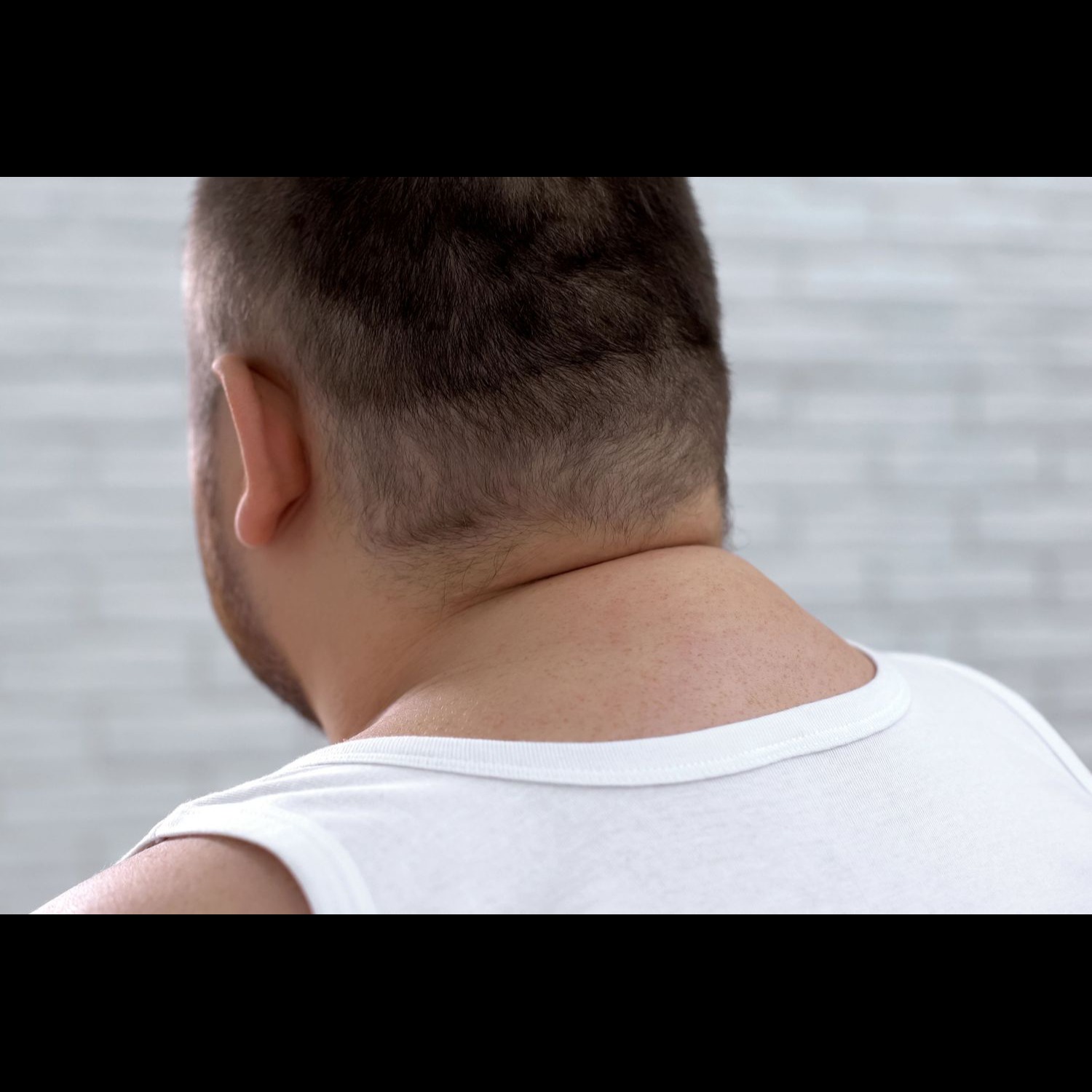 treatment for text neck sympto