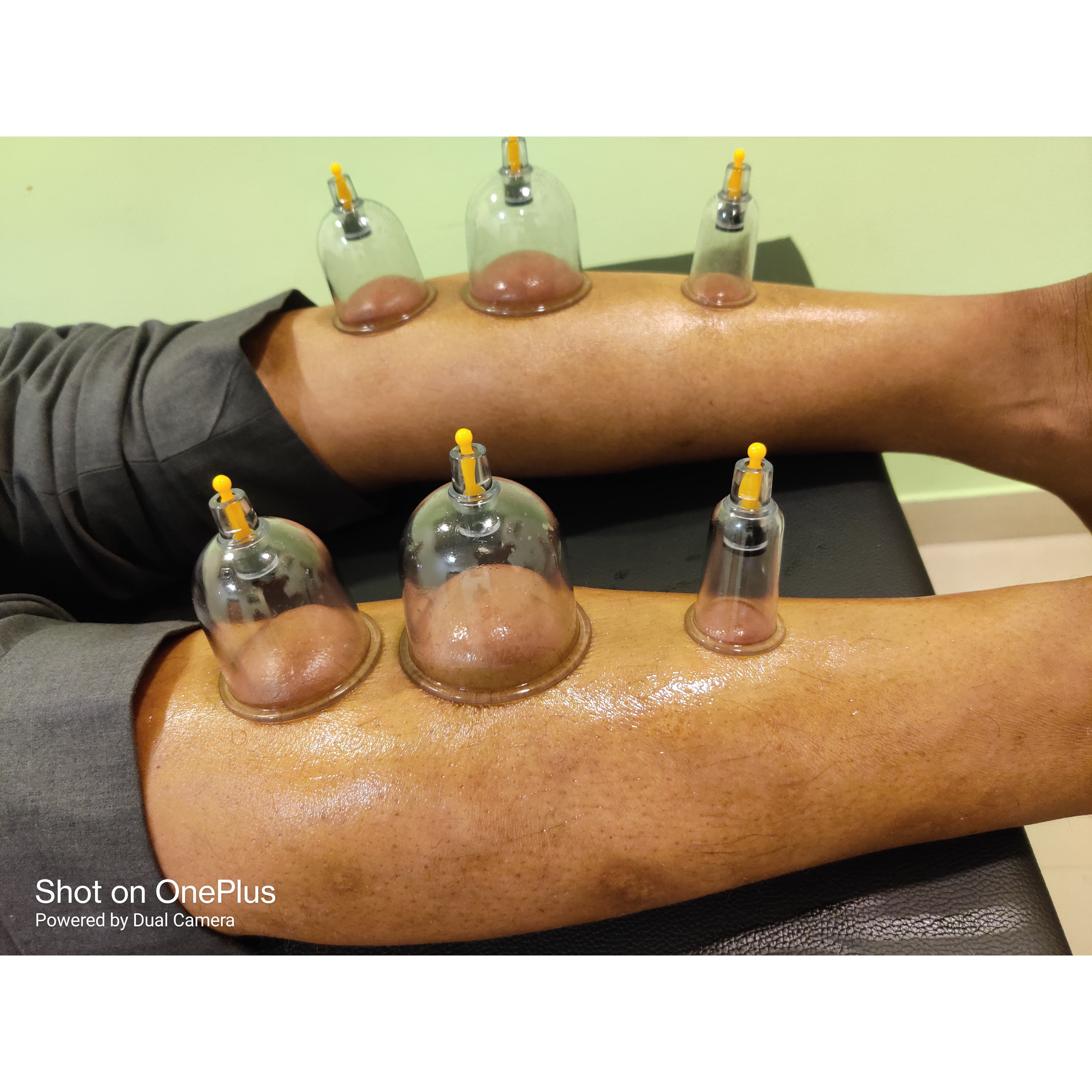 improve blood flow