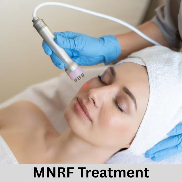 radiofrequency mnrf