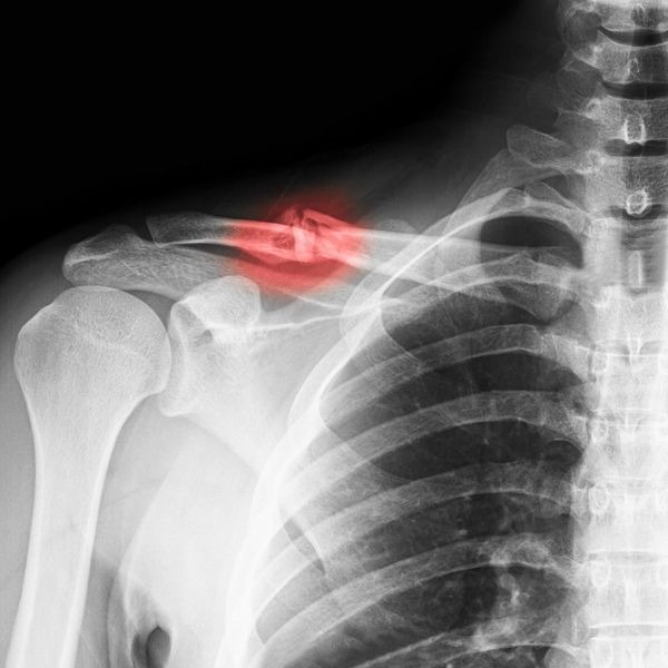 injury physiothereapy