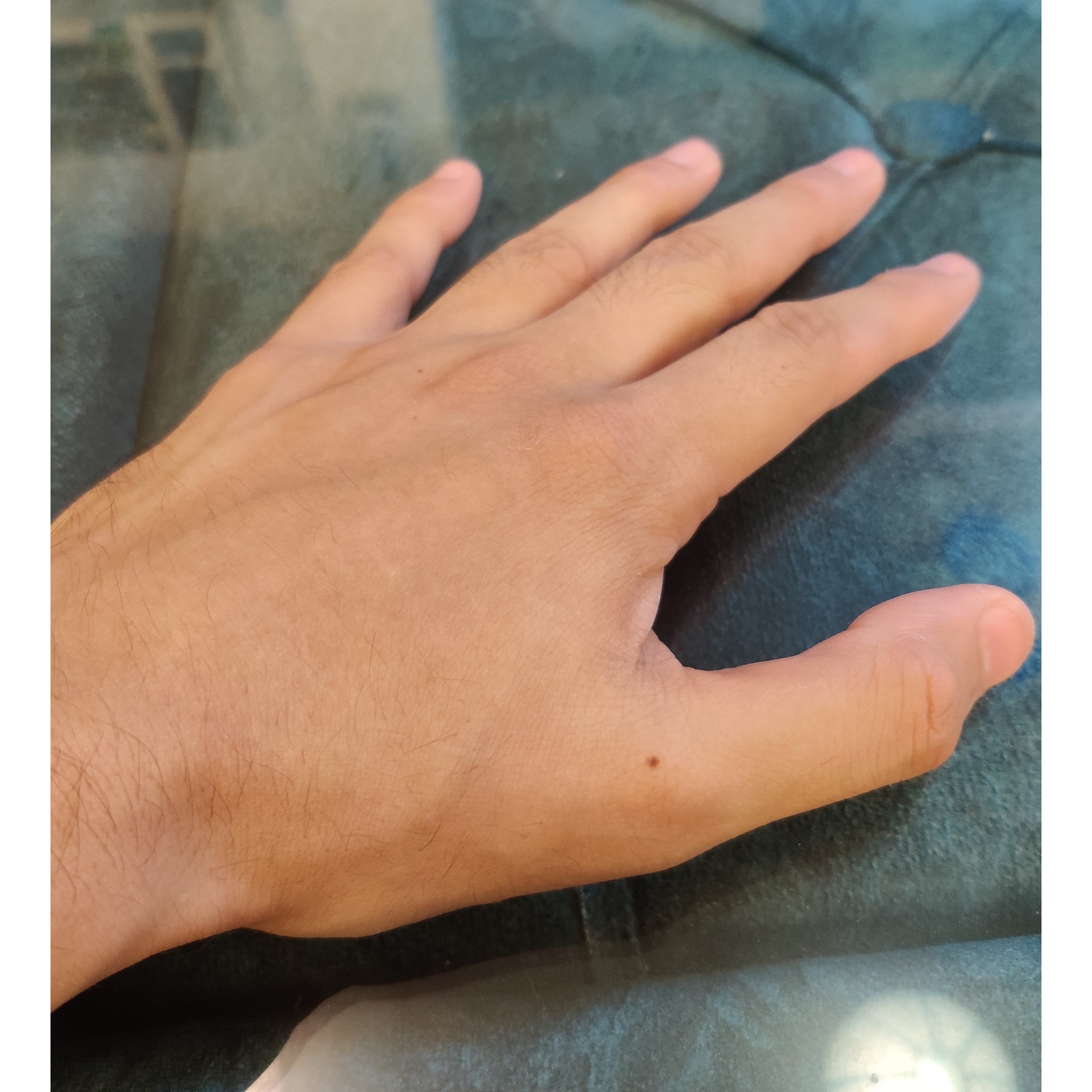 tenosynovitis symptoms