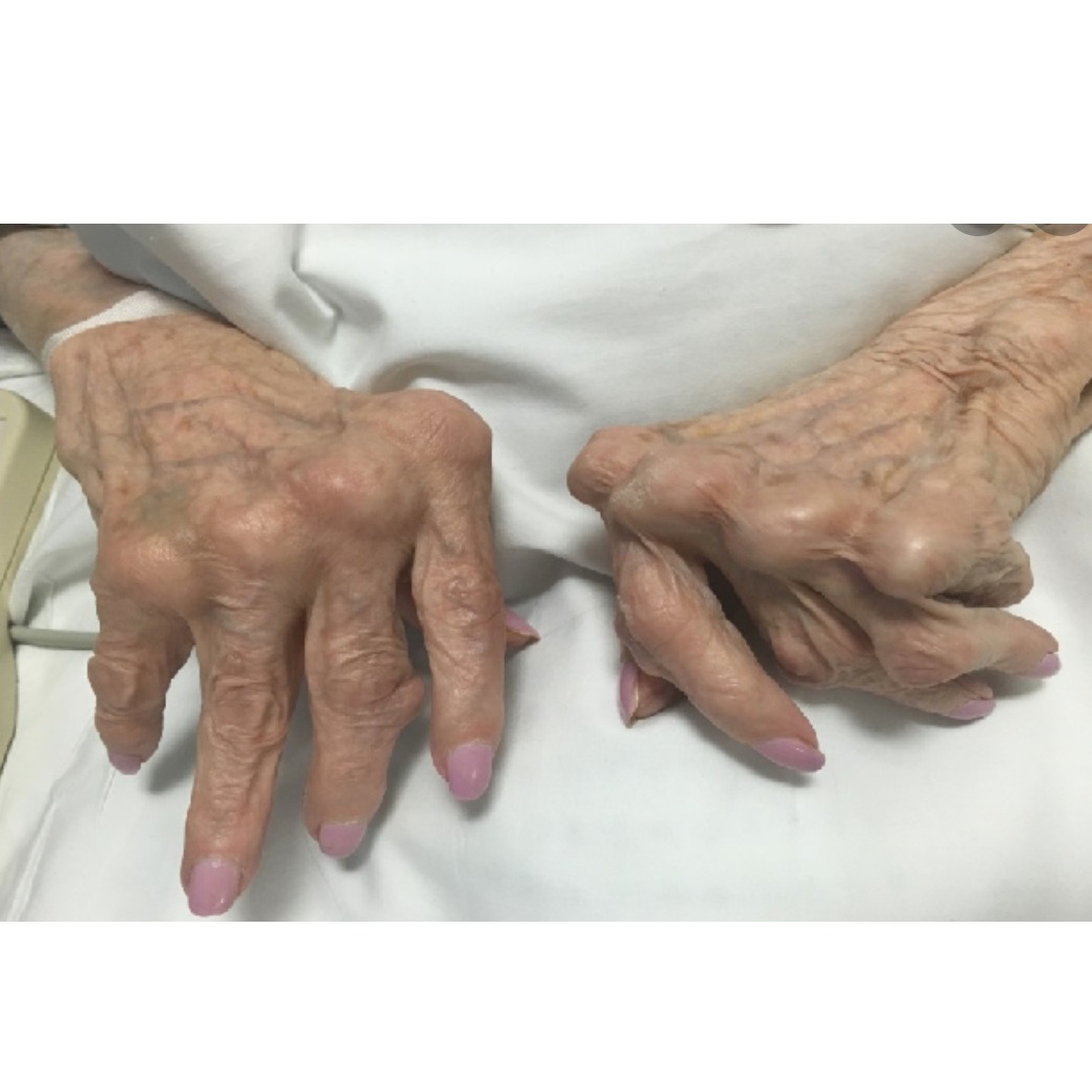 functionality patients
