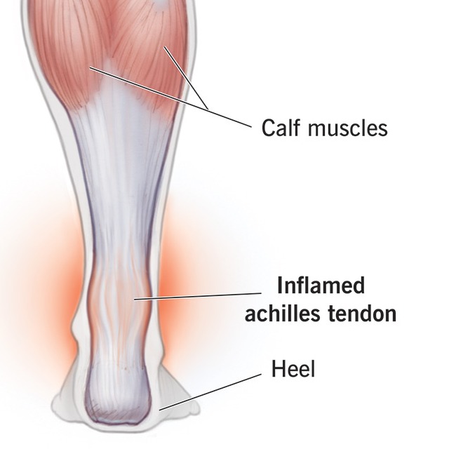 connective tissue running