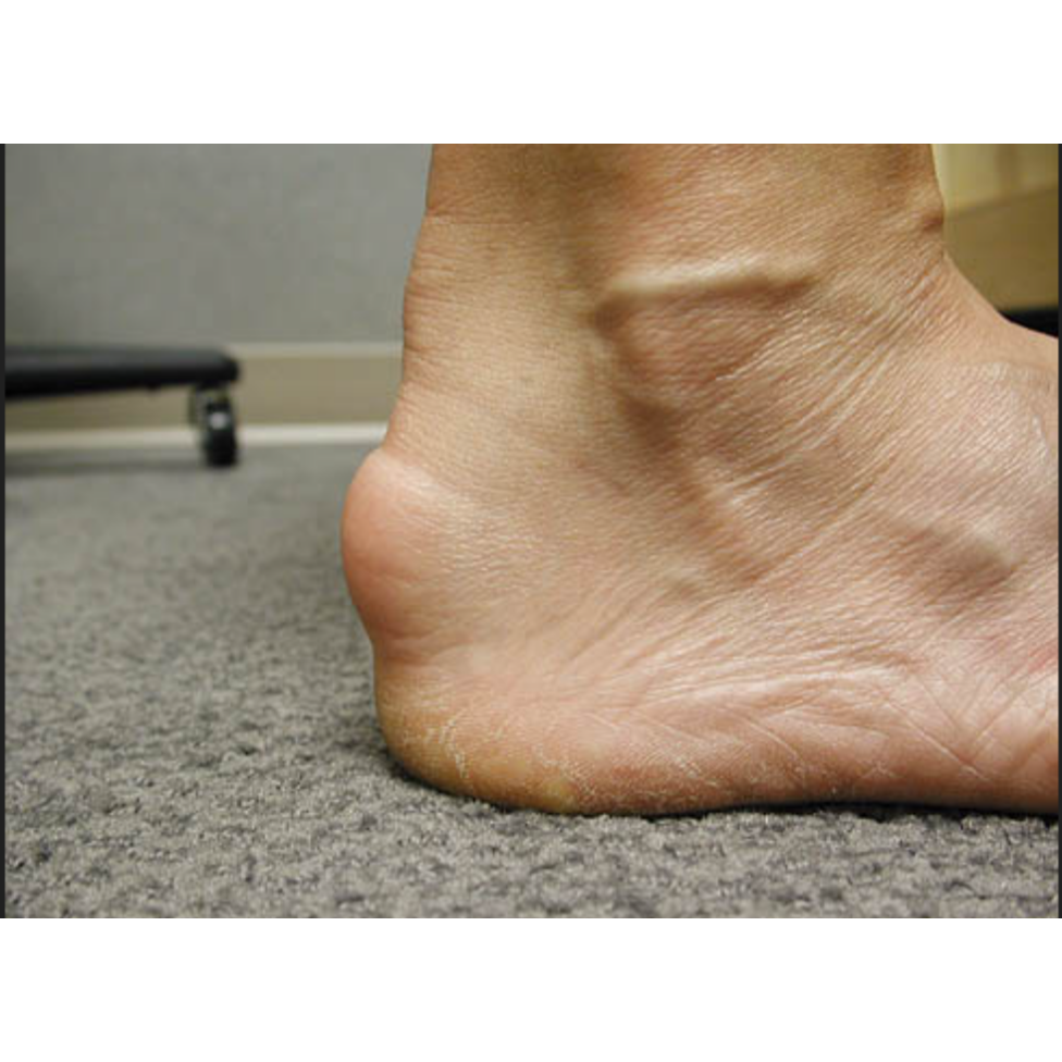 expert physiotherapy care for 