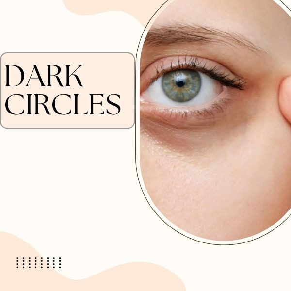 dark circles treatment in pune