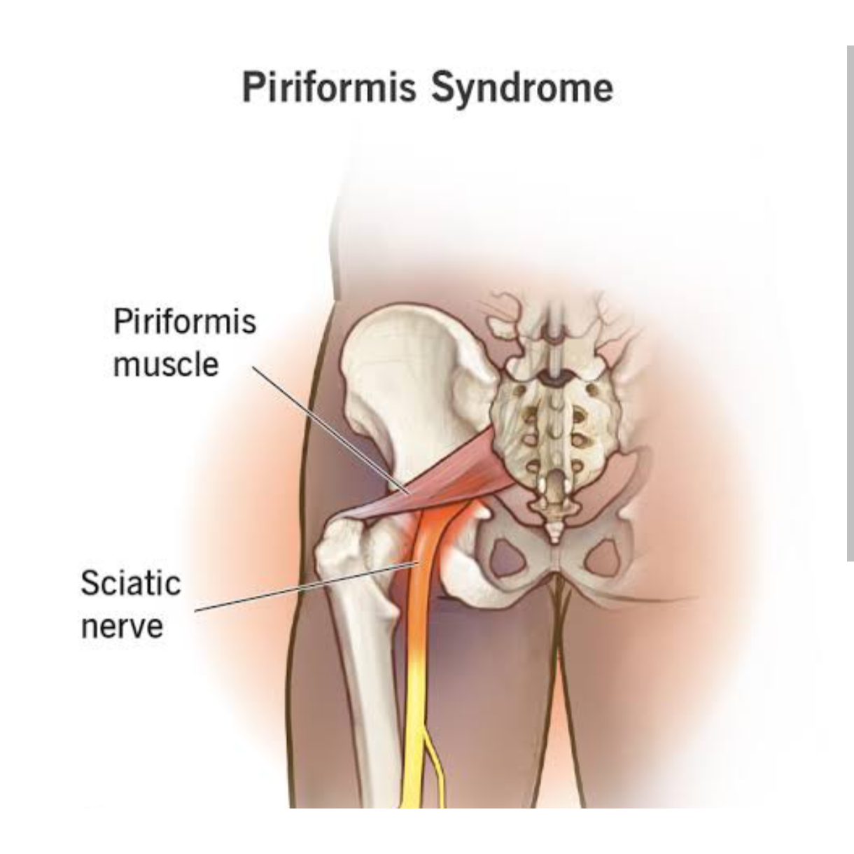 physiotherapy stretches for fl