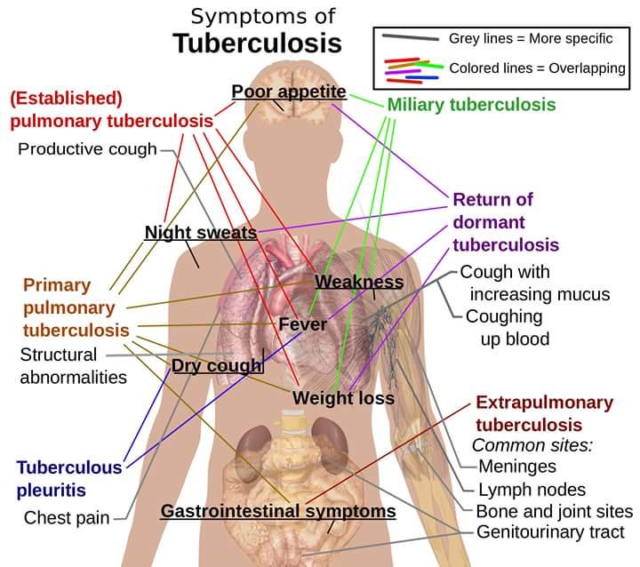 Tuberculosis is the most common oppertunistic i... main image