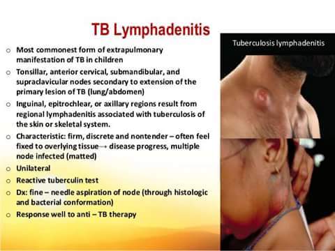 TB LYMPHADENITIS  VERY COMMON IN HIV/AIDS main image