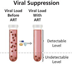 undetectable  viral load key to hiv treatment succ... main image