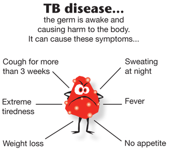 suspect TB in case of these symptoms in a hiv pati... main image