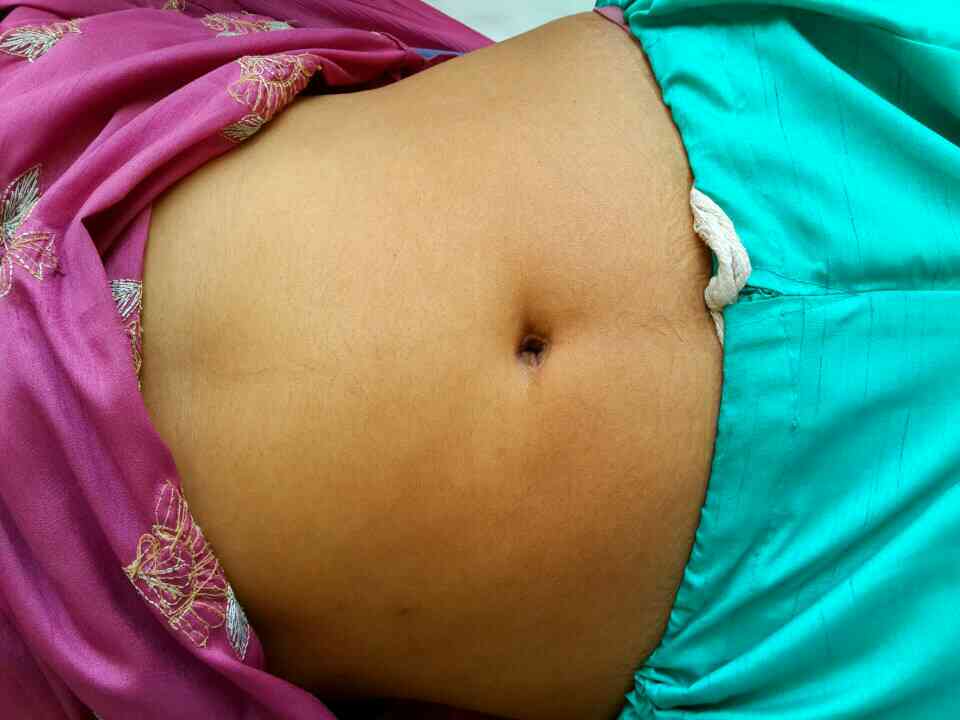 This is how abdomen