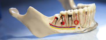 During root canal or