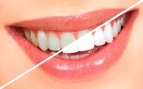 We at Arora’s Dental