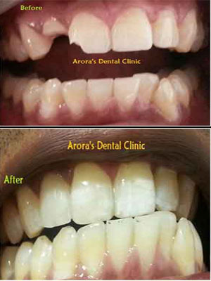 Cosmetic Dentist in