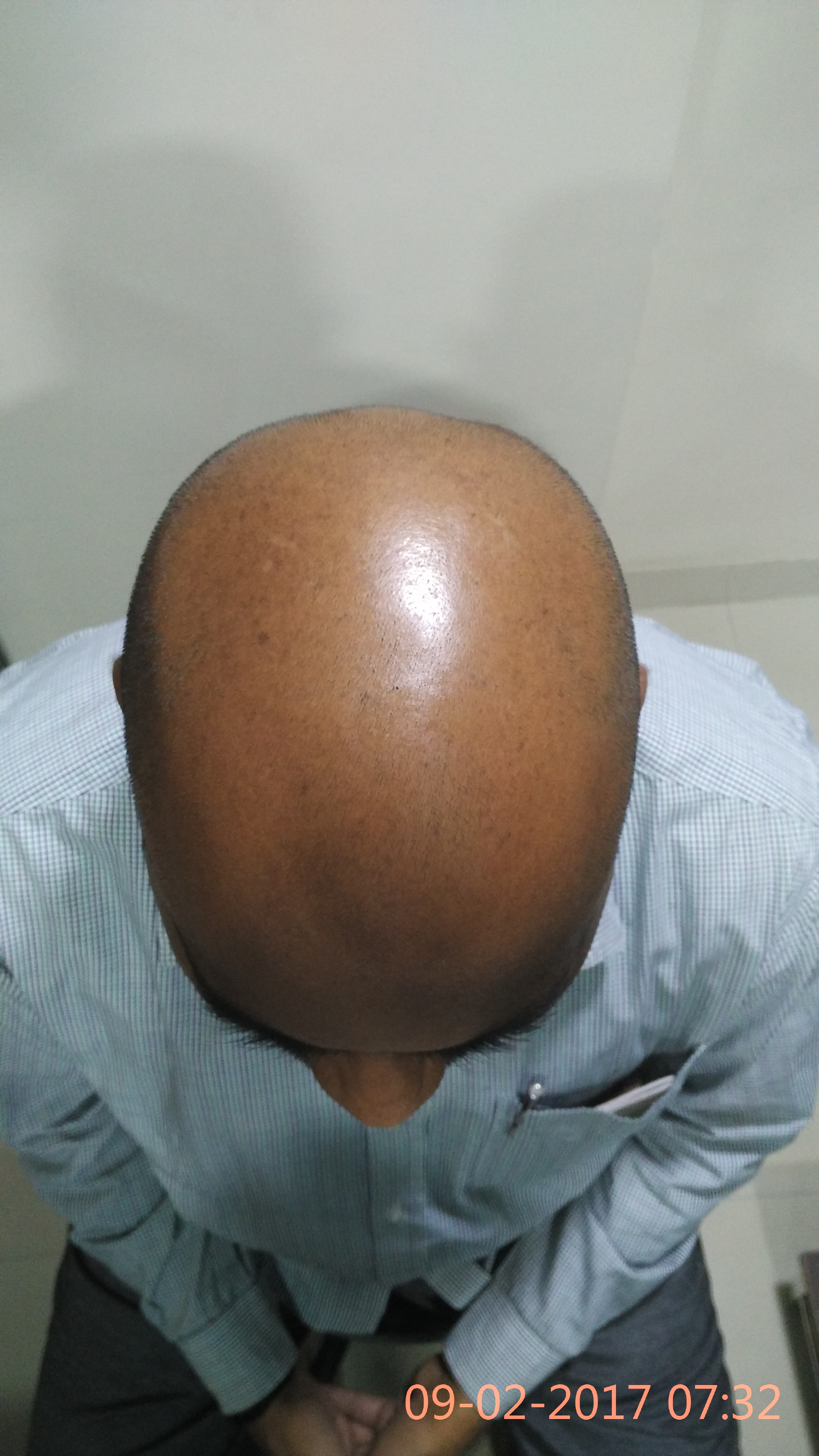 update image