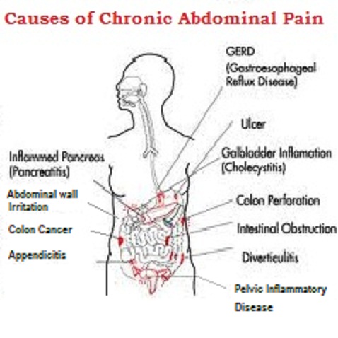why children have chronic abdominal pain why children have chronic abdominal pain