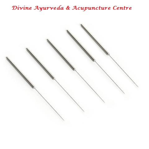 FAQ’s On ACUPUNCTURE