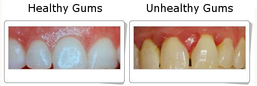 TODAY's ORAL HEALTH UPDATE: 
How to maintain he... main image