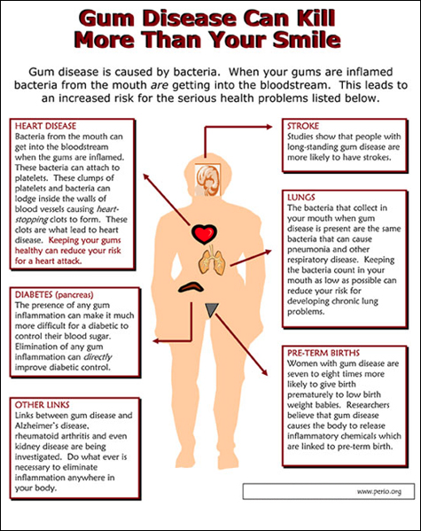 TODAY's ORAL HEALTH UPDATE:
Gum disease is inte... main image