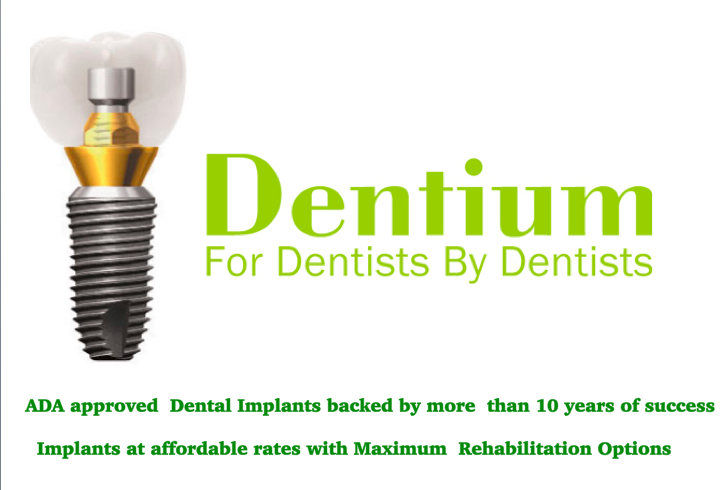 Dental Implants in Sector 17 Faridabad, Implant... main image