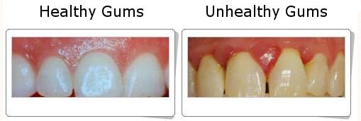 Best 'Gum Care' dental services at Dr. Rishi's ... main image
