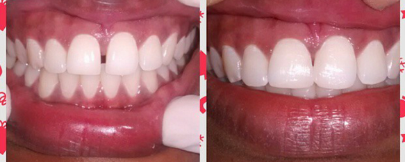 Cosmetic dental treatment can be used to correc... main image