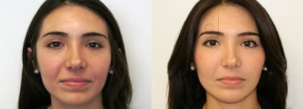 Hair treatment clinic in Mulund West main image