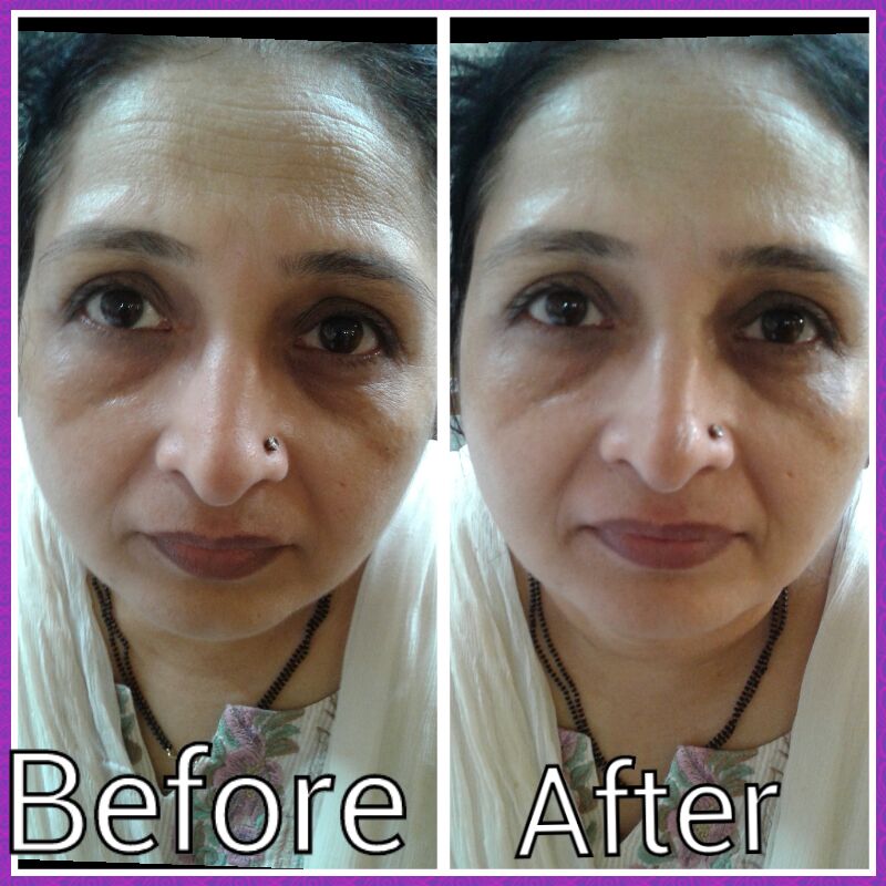 Skin Tightening Laser Treatment Clinic In Mulund.
... main image