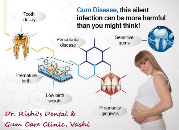 Dental treatment is safe during 2nd trimester o... main image