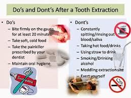 Dental Implant Do’s