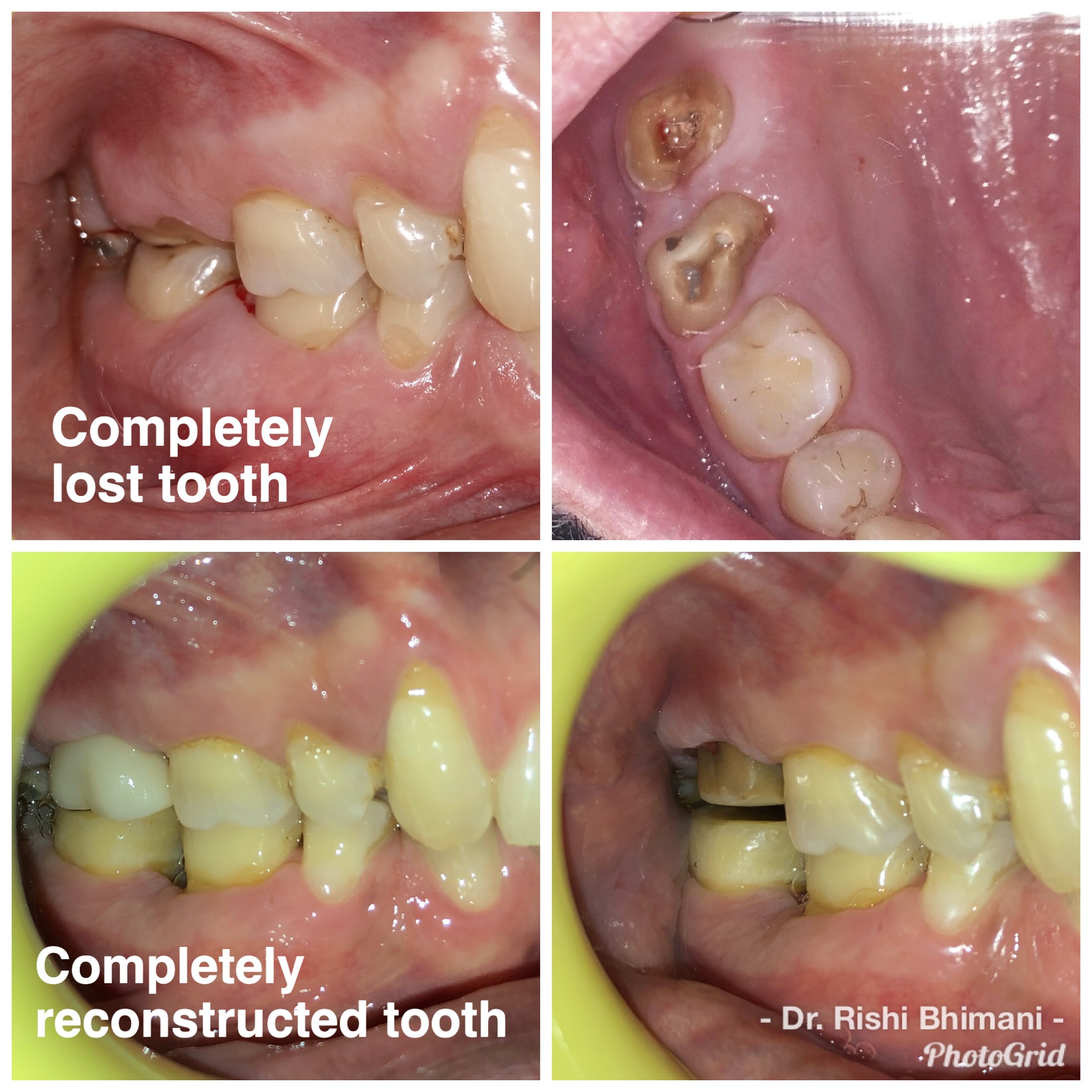 Reconstruction of severely damaged and lost nat... main image