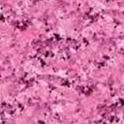 Rosy Pink Granite..