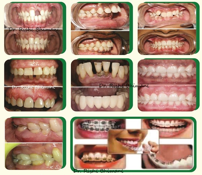 Experience Best multi-specialty dental treatmen... main image