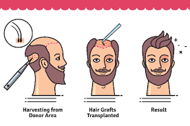 Tips For post Hair T