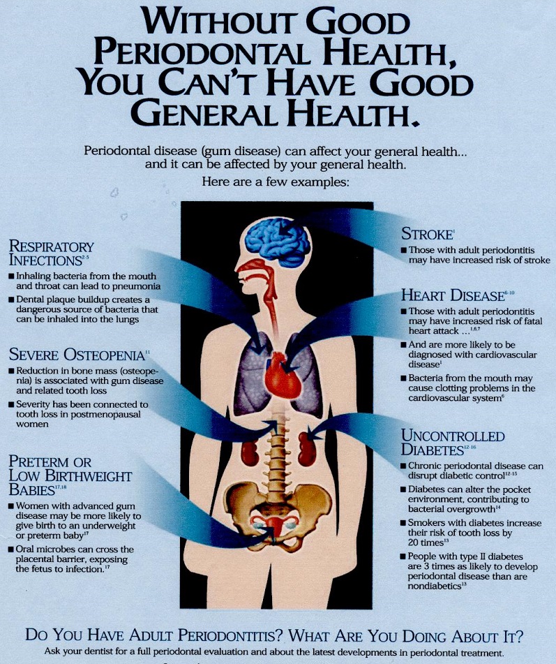 Poor oral health may be the cause of chronic he... main image