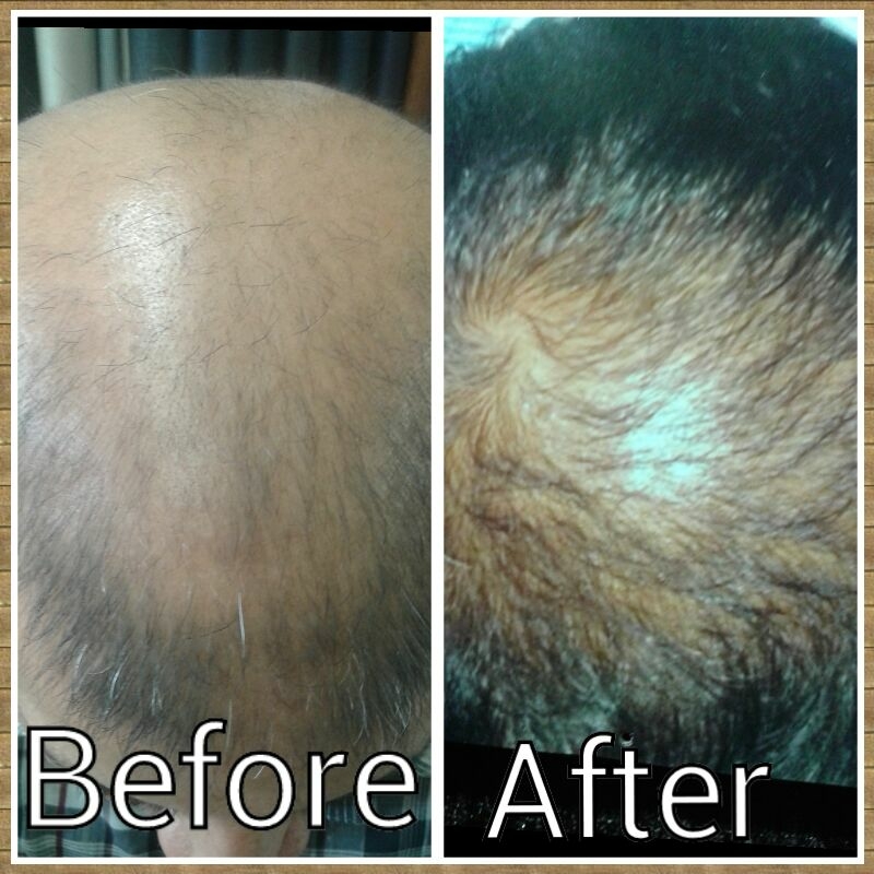 BEST HAIR growth TREATMENT IN MULUND . main image