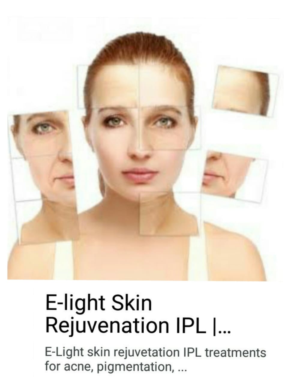 E-LIGHT SKIN REJUVEN