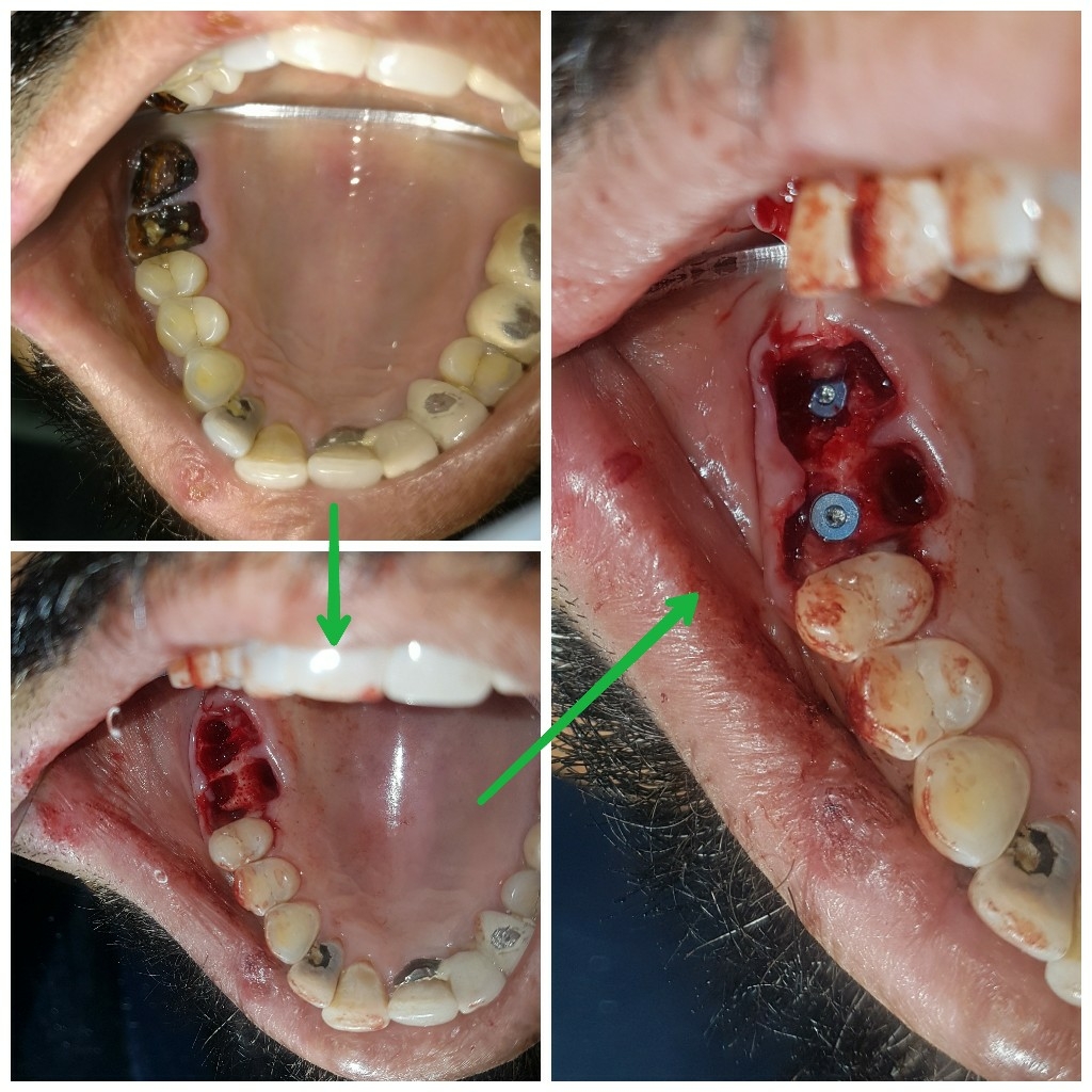 update image