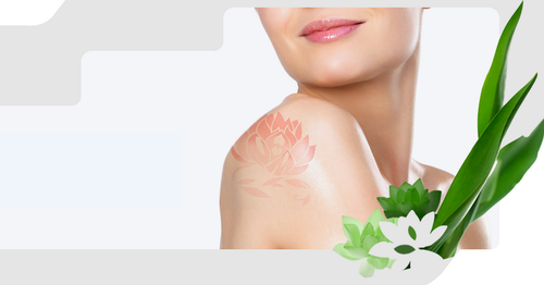 Laser Tattoo And Birthmark Removal Service Clin... main image