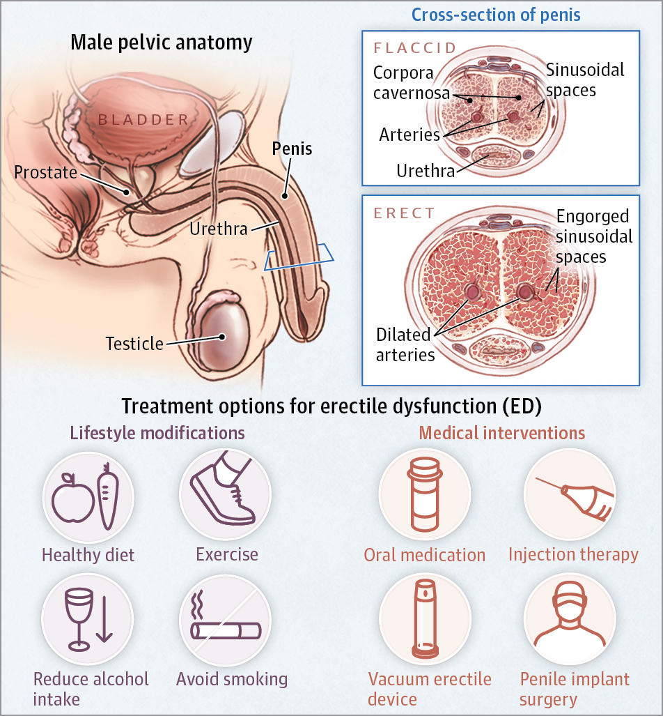 Erectile dysfunction Causes & effective Herbal medicines..