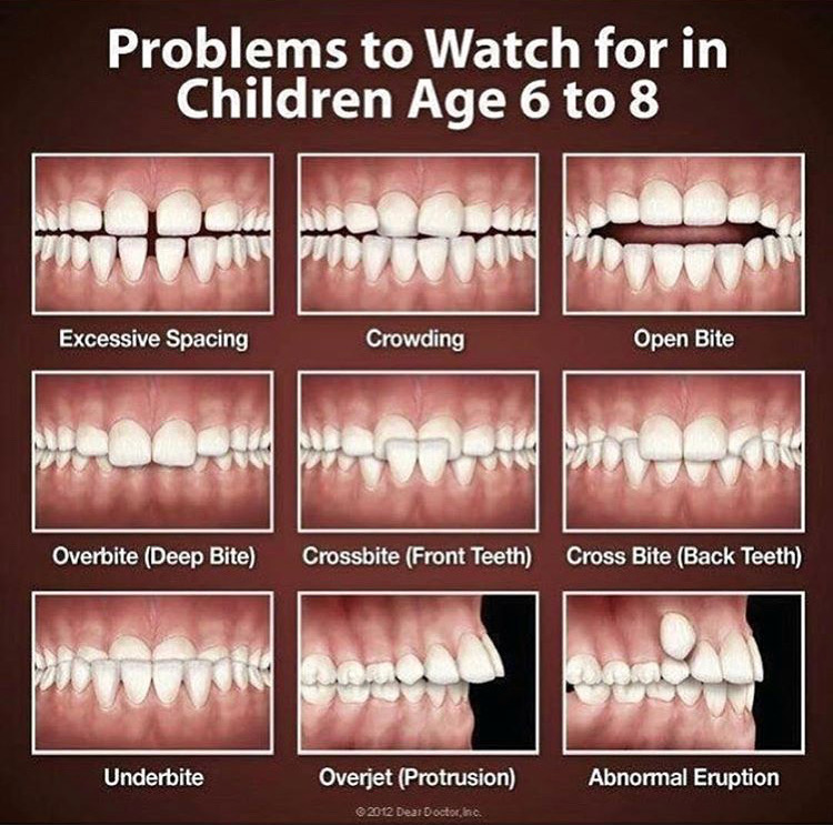 Malaligned teeth contribute to unaesthetic smil... main image
