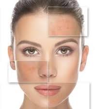 SKIN TAG REMOVAL