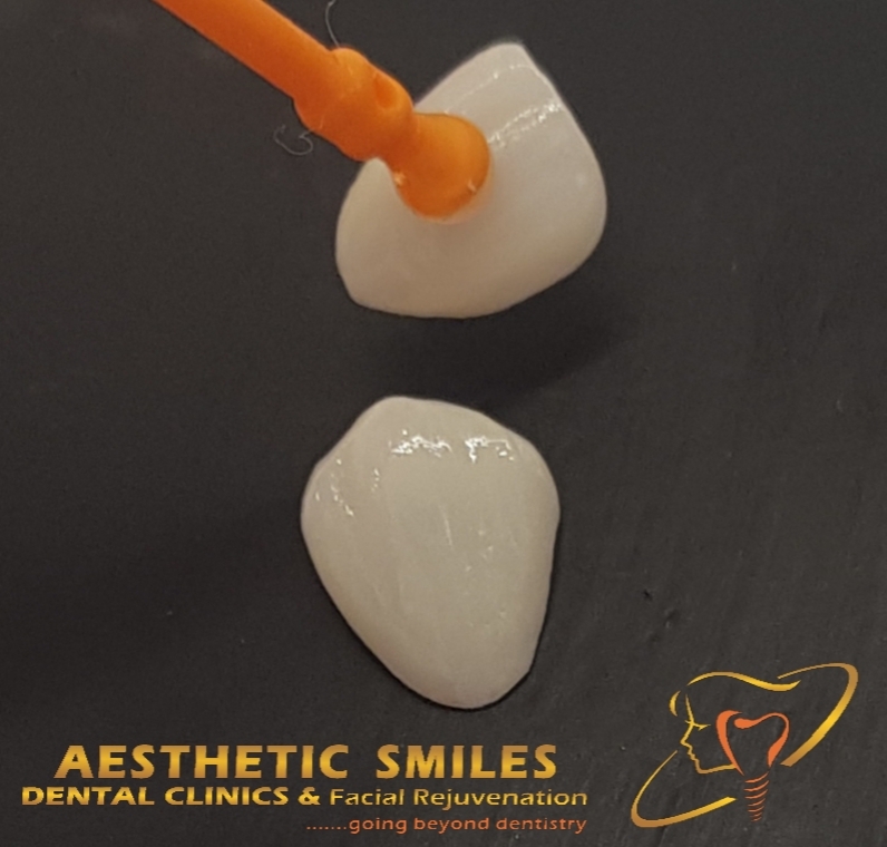 Affordable Porcelain