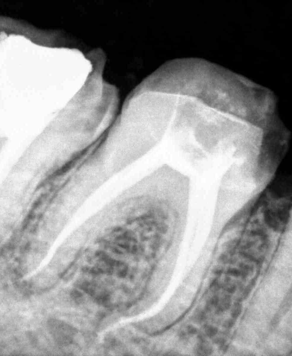 Have a severe toothache?
Visit Dr Chauhan's Dental... main image