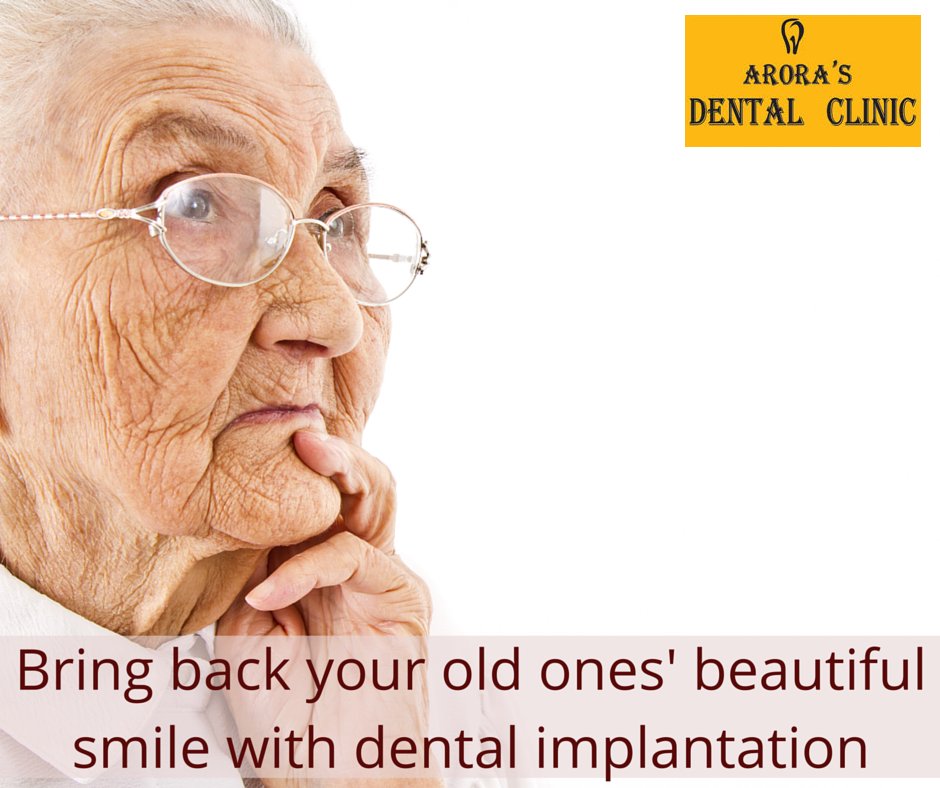 Dental Implant Proce