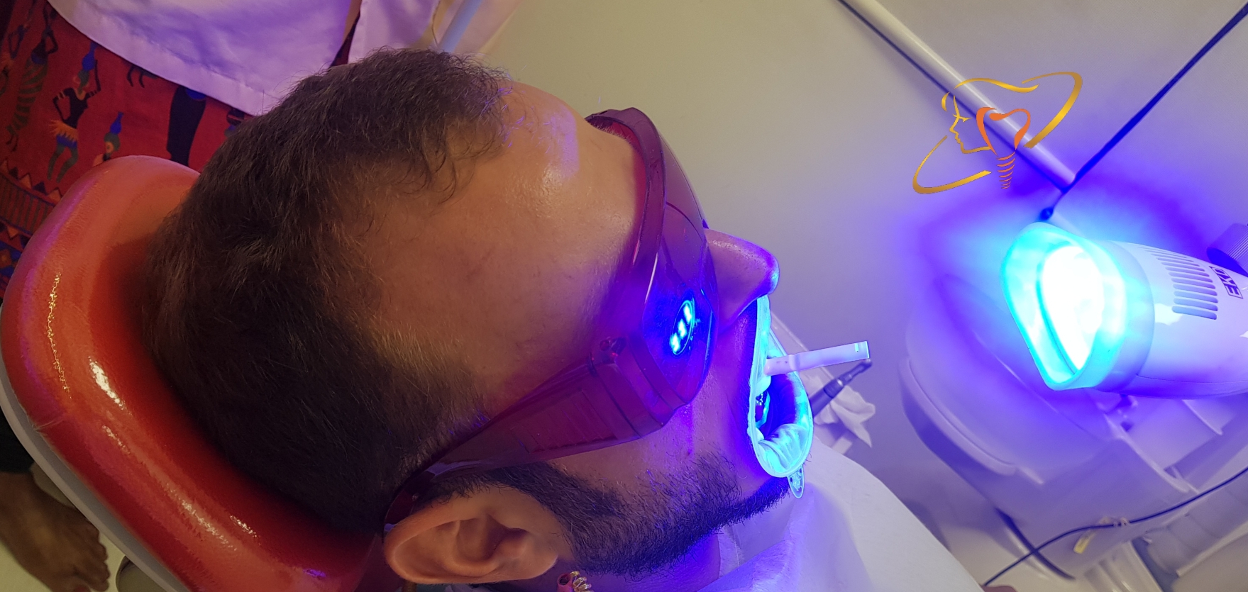 Laser Teeth Whitenin
