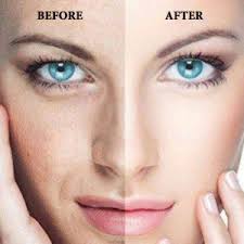 Get 3 sessions of Instant Glow Treatment as a g... main image