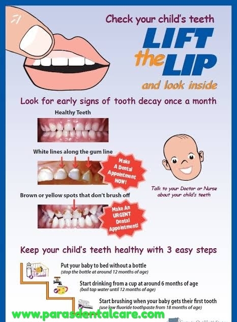 Oral health care should not be neglected even f... main image