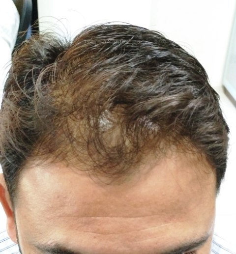 update image