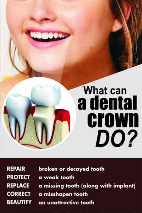 DENTAL CROWN
Dental crown is a cover or “cap” whic... main image